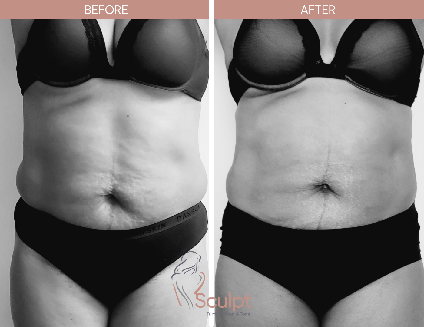 Before & After - Waist and Hips